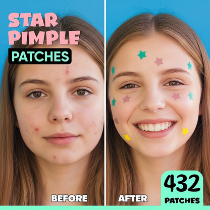 432 Colorful PE Pimple Patches Cute Star Shaped Pimple Cover Sticker Invisible Pimple Cover Removal Pimple Patch